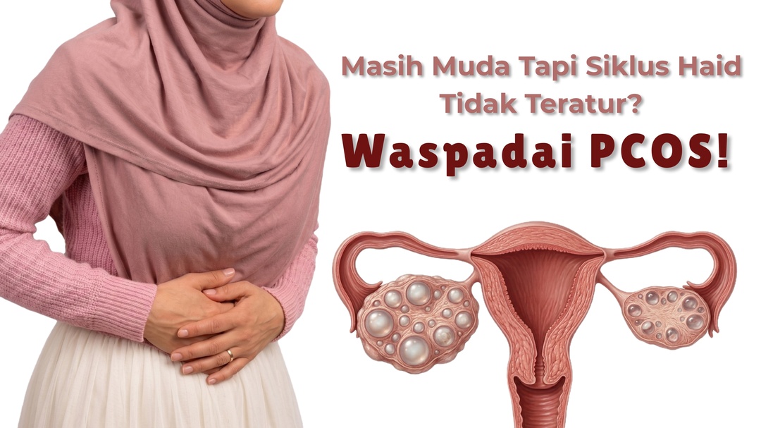 Masih Muda Tapi Siklus Haid Tidak Teratur? Waspadai PCOS! | RS Roemani